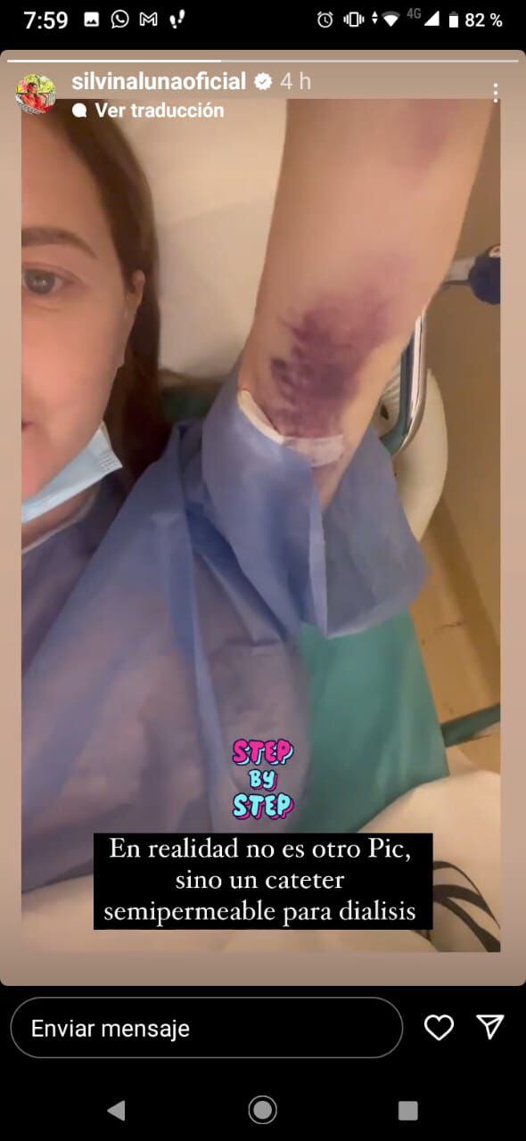 Silvina Luna mostró el hematoma que tiene en el brazo antes de entrar al quirófano (Instagram)