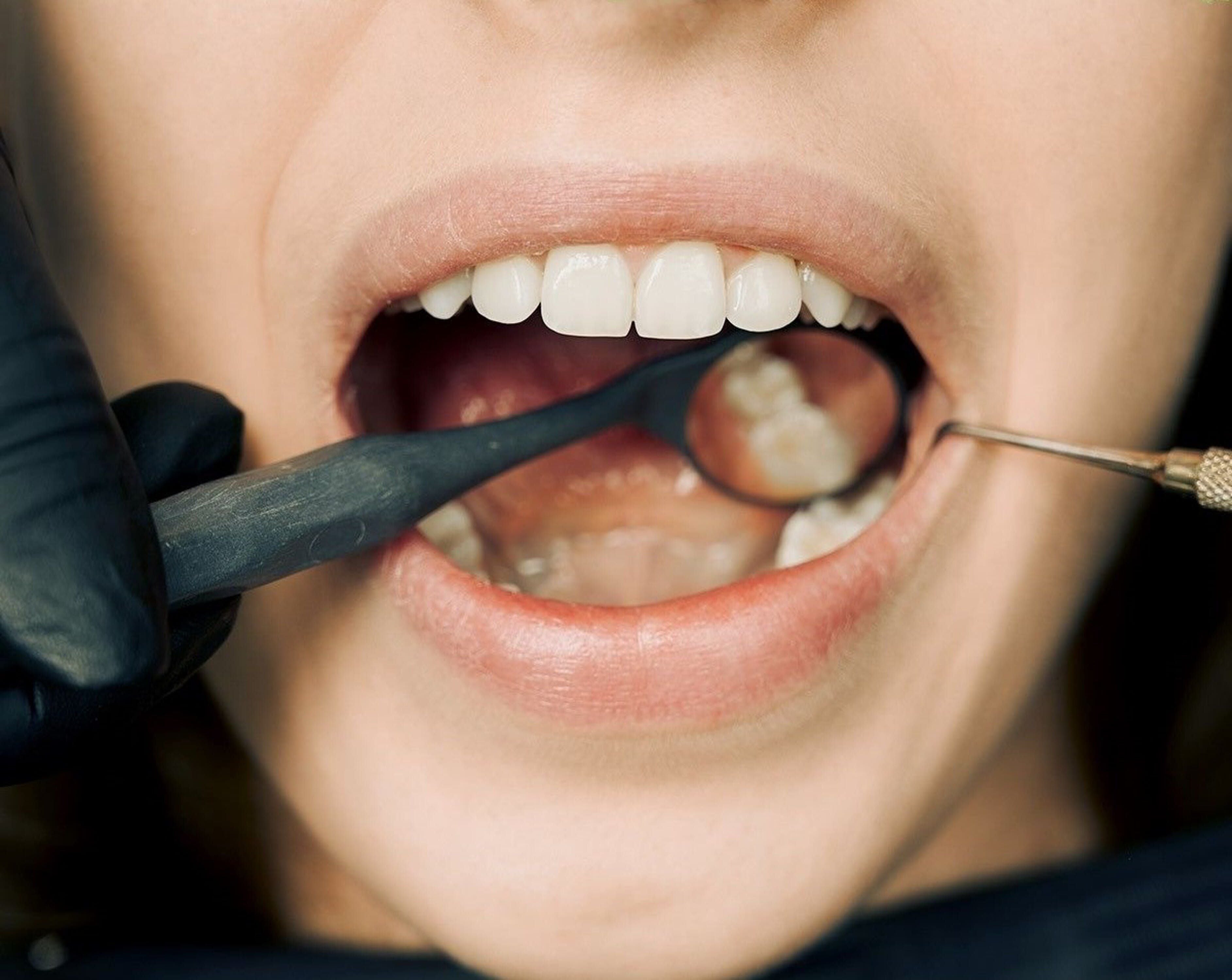 El riesgo de las férulas dentales para tu salud