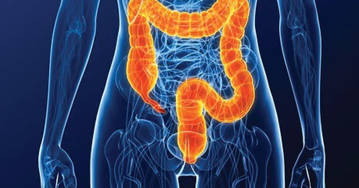 A New Simple and Inexpensive Test can help Save Lives from Colorectal Cancer