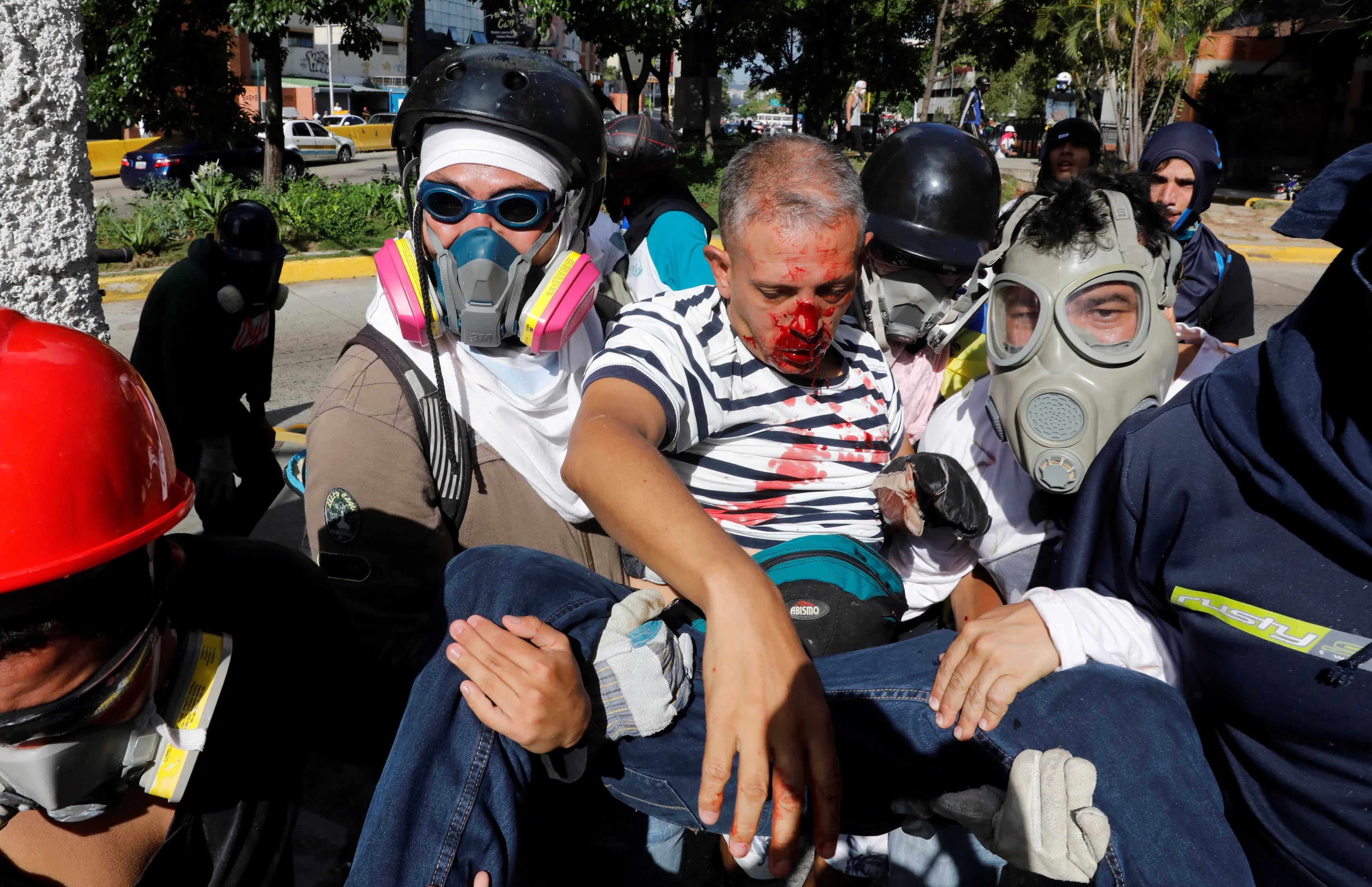 Manifestante herido por la represión del régimen militar en Caracas (Reuters)