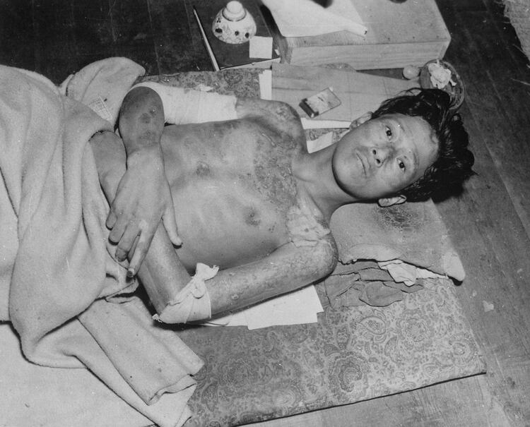 Las heridas de los sobrevivientes eran aterradoras, sus pieles se desprendían como cáscaras de mandarina (War Department/U.S. National Archives/ REUTERS)