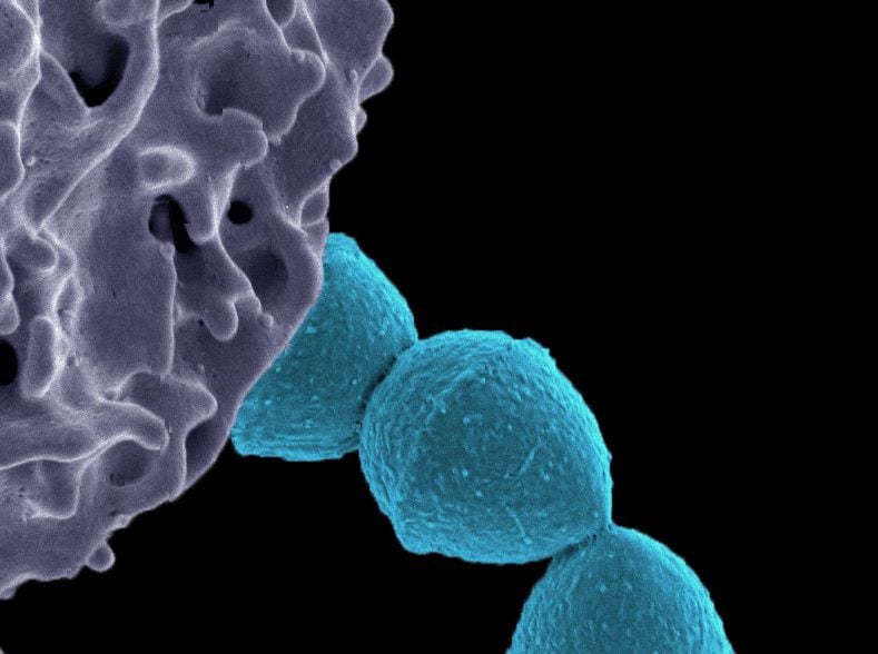 This is a scanning electron micrograph of the interaction of Streptococcus pyogenes (rounded blue objects) with a human neutrophil (large purple objects with ruffles and extensions).  CREDIT National Institute of Allergy and Infectious Diseases