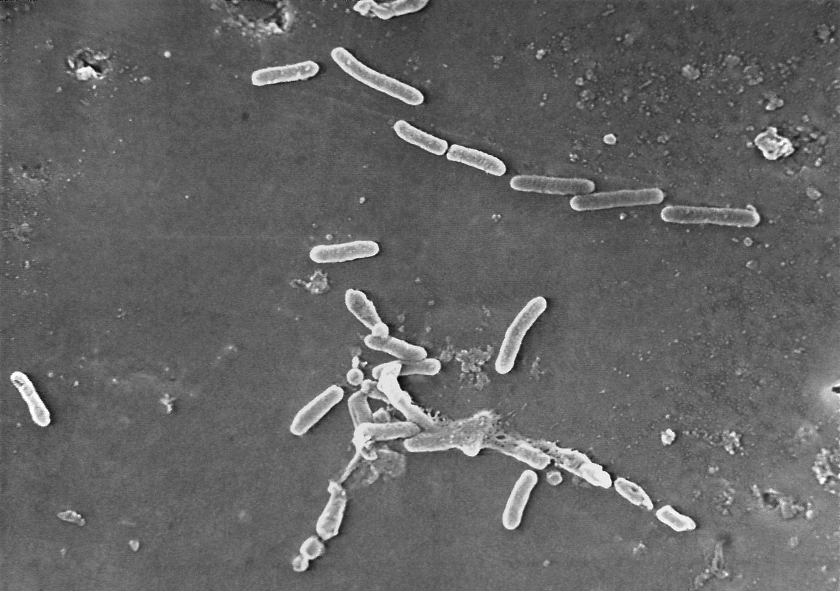  Aumentó el nivel de resistencia en el caso de algunas bacterias de ‘campylobacter’ que mantuvieron una tendencia creciente en la resistencia al antibiótico ciprofloxacina. (Janice Haney Carr/CDC vía AP, Archivo)