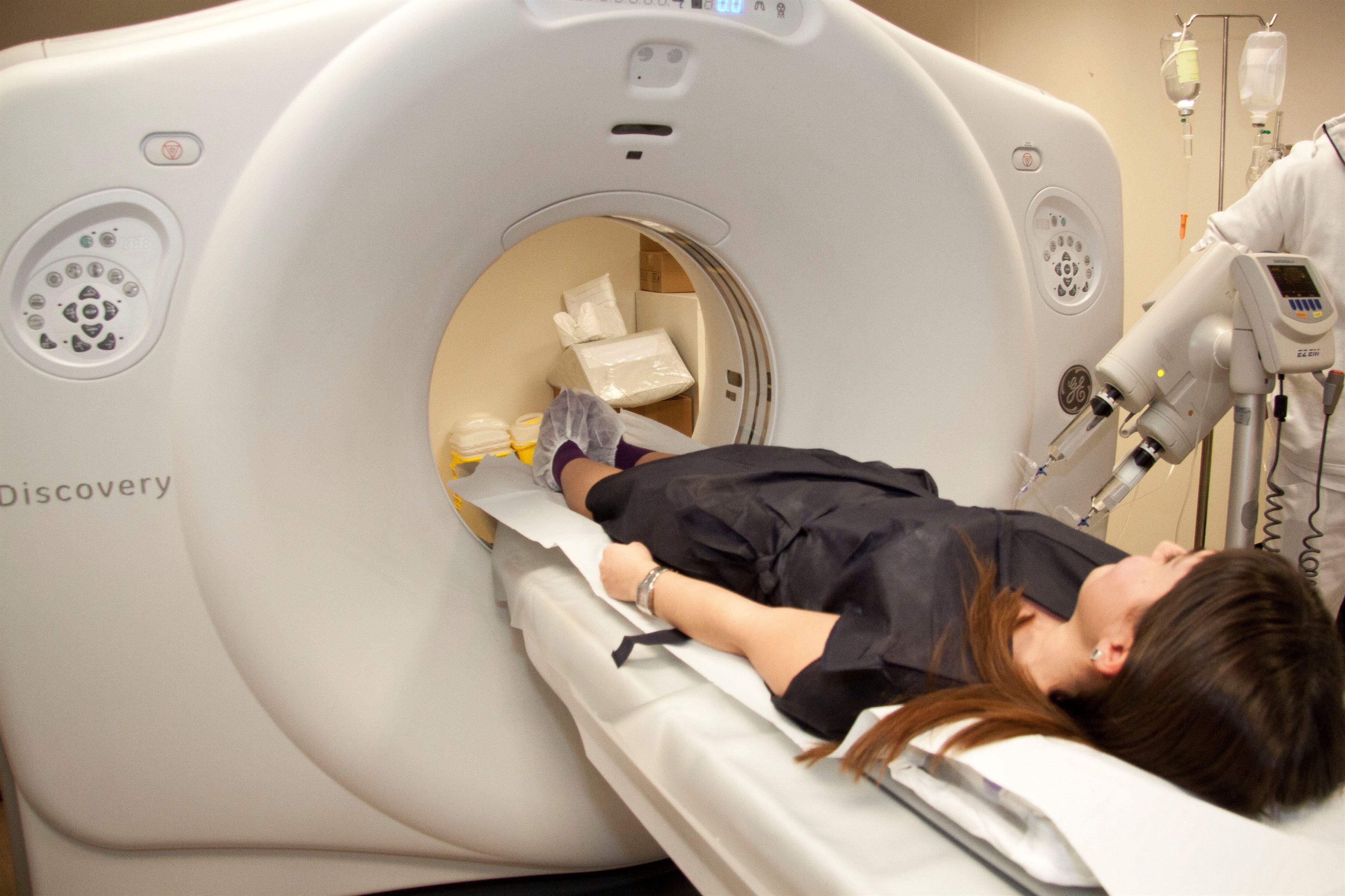 La tomografía computada es uno de los métodos más eficaces para diagnosticar el cáncer de pulmón (Europa Press)