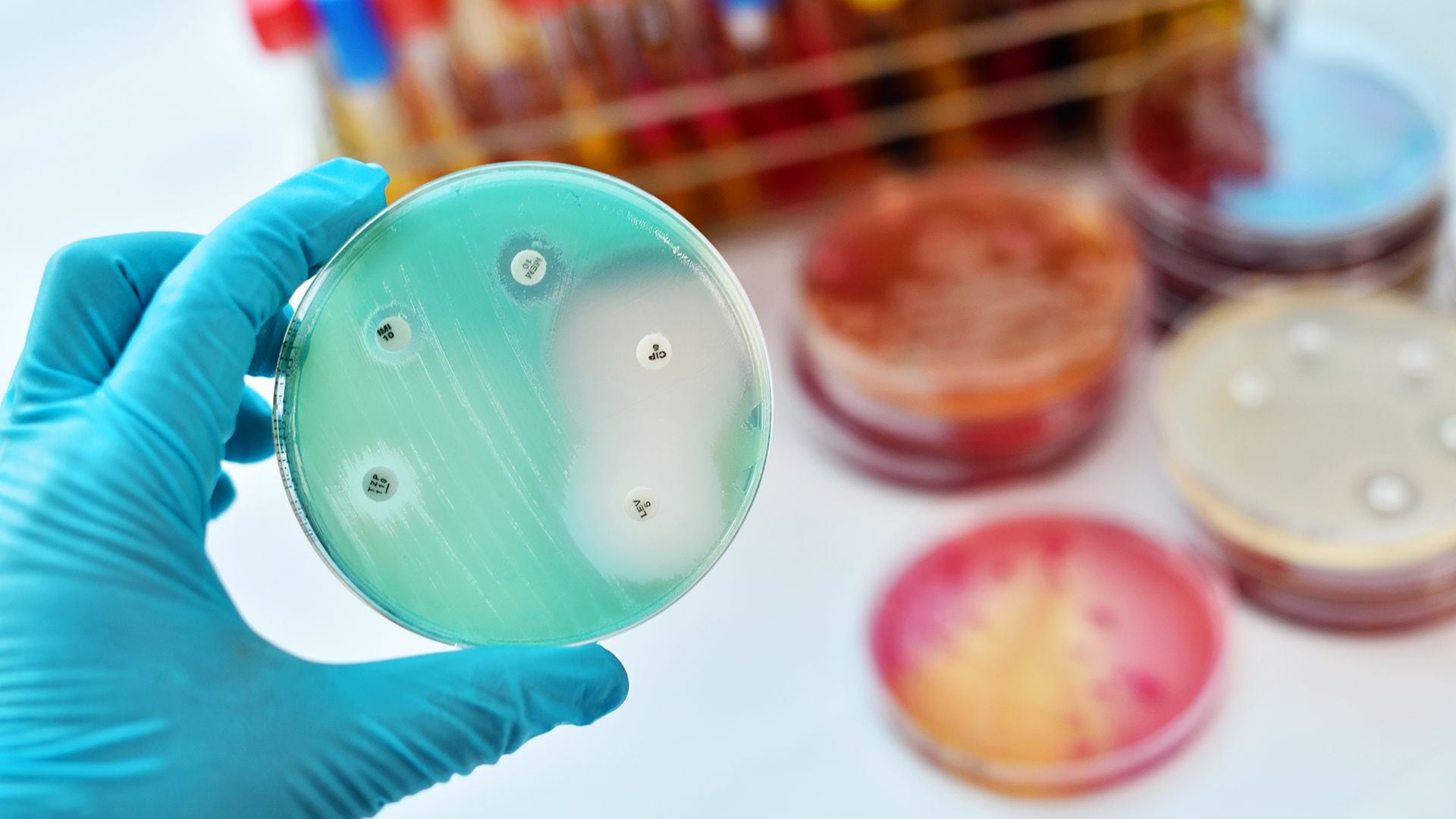 En 2019, la OMS determinó que había solo 32 antibióticos en fase de desarrollo clínico capaces de combatir los patógenos de su lista de patógenos prioritarios/Archivo
