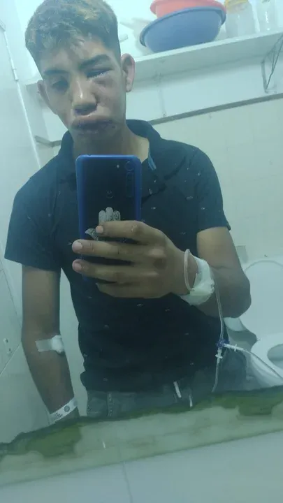 Así quedó Nazareno post golpiza