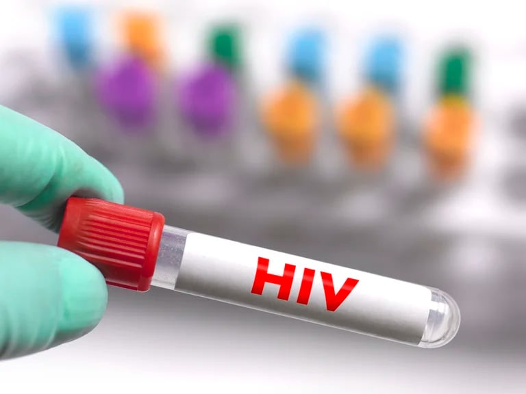  Los países con bajas cifras de diagnósticos de VIH registraron la mayor cantidad de muertes por viruela del mono (Getty