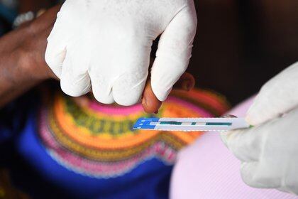 Se hizo la primera fase de un estudio con una vacuna para VIH en base a la información sobre generación de anticuerpos naturales que algunos pacientes producen. Aún falta hacer más ensayos clínicos para evaluar eficacia y seguridad. SALUD
UNICEF/UN061633/DEJONGH / UNICEF/FRANK DEJONGH
