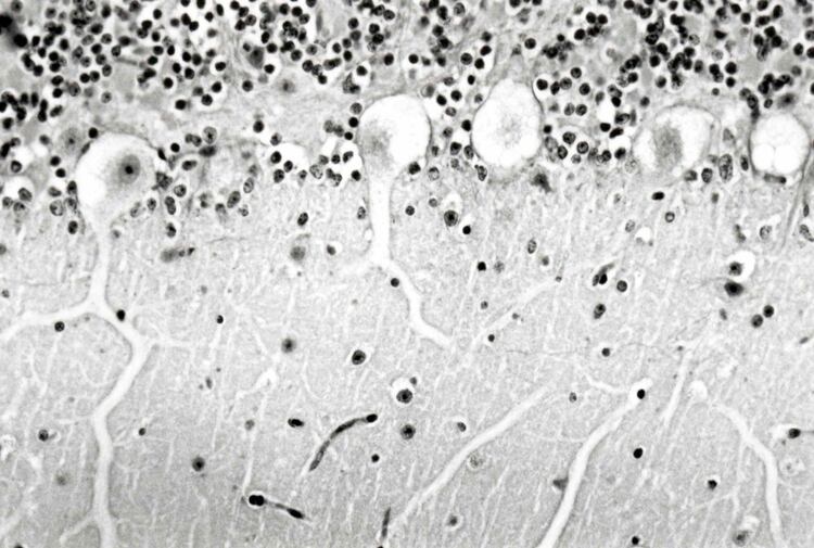 Esta patología afecta el sistema nervioso de los animales