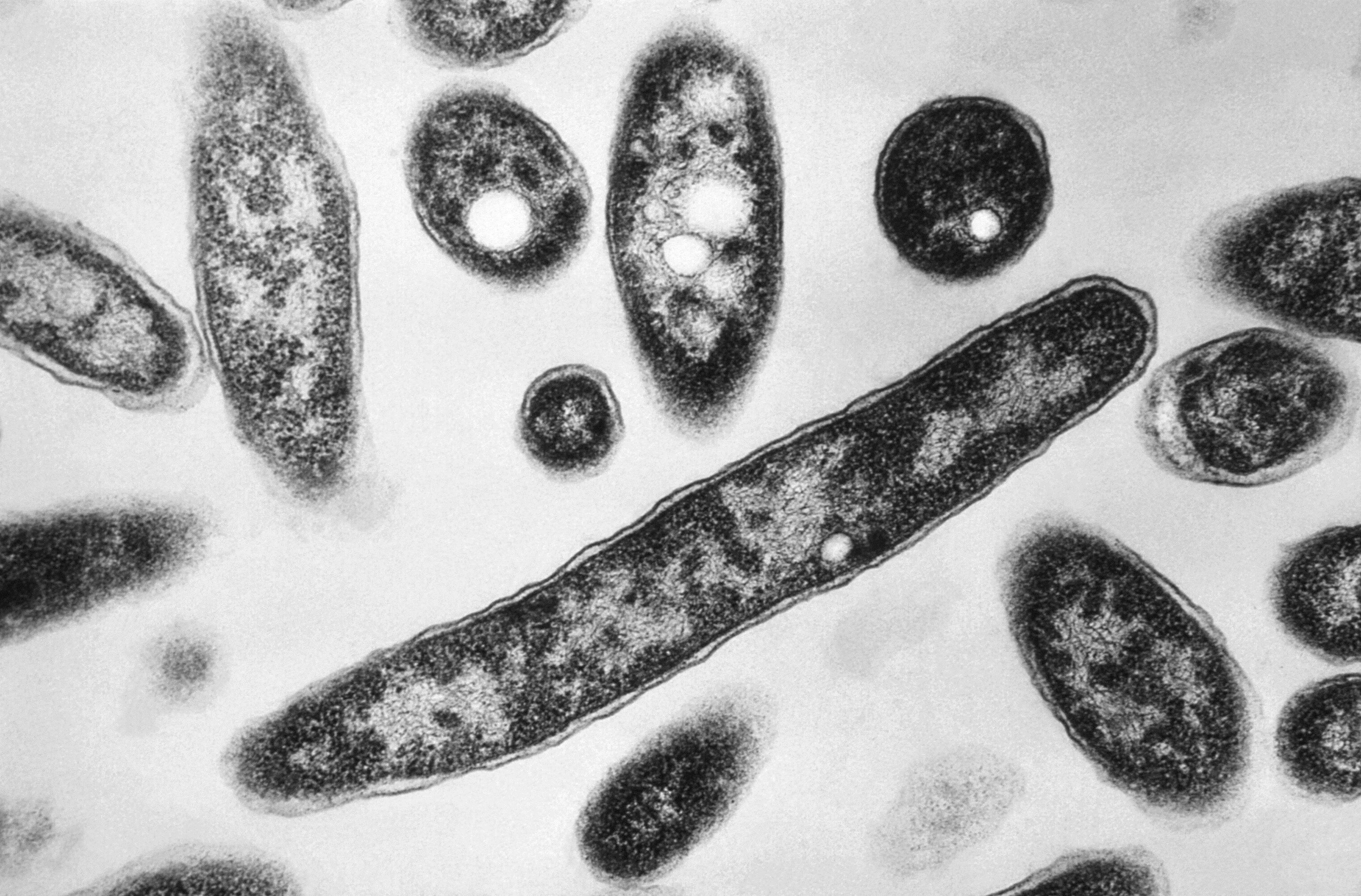 ARCHIVO - Esta imagen de 1978 tomada por microscopio electrónico y distribuida por los Centros de Control y Prevención de Enfermedades, muestra la bacteria Legionella pneumophila, causante de la legionelosis, una enfermedad pulmonar. (Francis Chandler/CDC via AP, File)