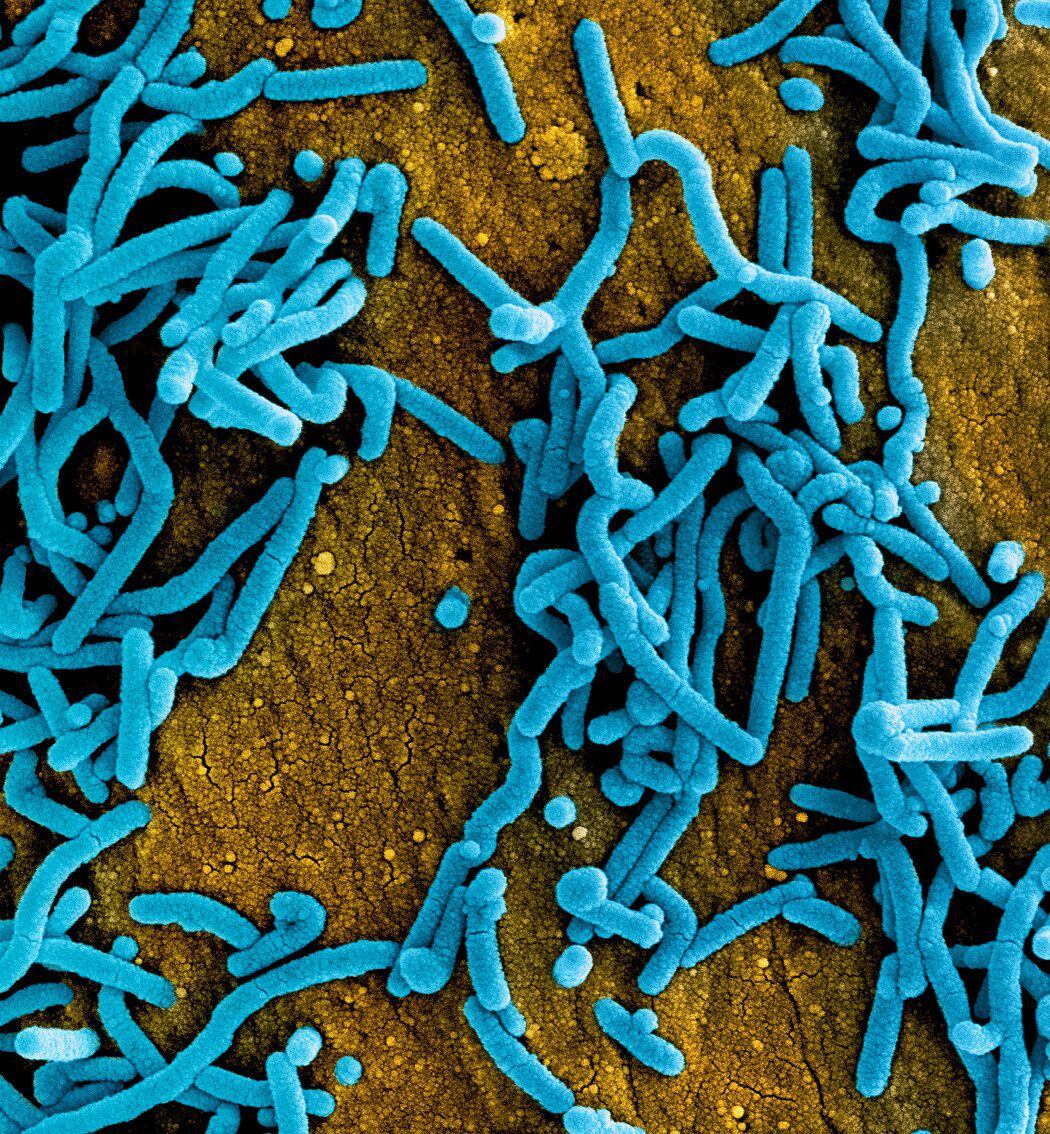 Colorized scanning electron micrograph of Marburg virus particles (blue) both budding and attached to the surface of infected VERO E6 cells (orange).CREDITNIAID