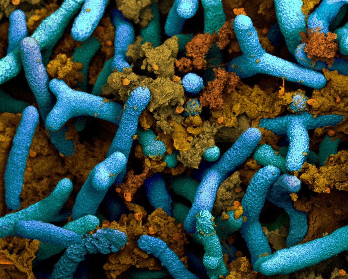Rhizobia (in blue) in the roots of a plant. The brown structures are plant proteins (coloured electron microscope image).CREDITETH Zurich / Anne-Greet Bittermann