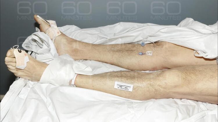 Las piernas del cuerpo de Jeffrey Epstein durante la autopsia. La familia y algunos forenses dudan de que se hubiera tratado de un suicidio (Gentileza 60 Minutes/CBS)