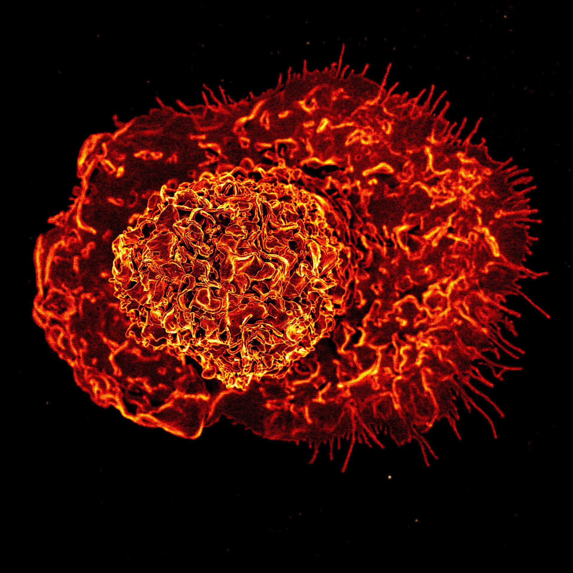 Micrografía electrónica de barrido coloreada de un macrófago, una de las células inmunitarias innatas derivadas de los monocitos: los detalles del estudio 
(Gentileza Instituto Nacional de Alergias y Enfermedades Infecciosas (NIAID))