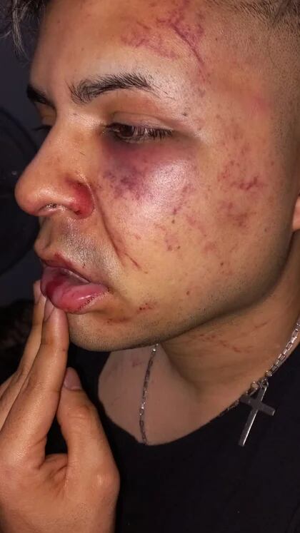 Imagen del joven atacado, compartida por @luismedinapiriz
