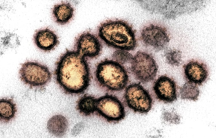 Las partículas del virus se muestran emergiendo de la superficie de las células cultivadas en el laboratorio. (NIAID-RML/Handout vía REUTERS)