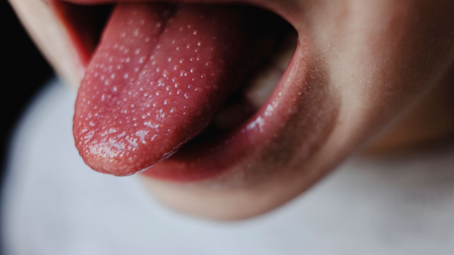 La fiebre puede producir cambios en la lengua (Gettyimages)