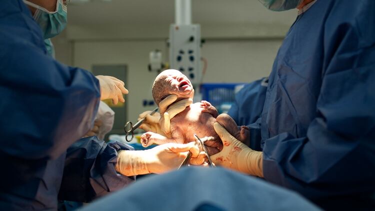 Muchas de las cesáreas que se realizan podrían evitarse si se respetan los tiempos de la mujer durante el trabajo de parto (Getty)