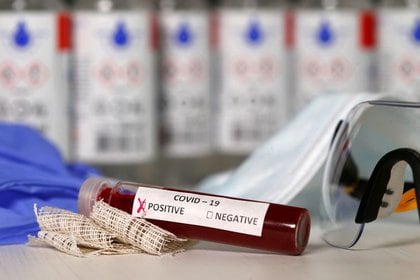 Imagen que muestra sangre falsa en tubos de ensayo etiquetados con el coronavirus (REUTERS/Dado Ruvic)