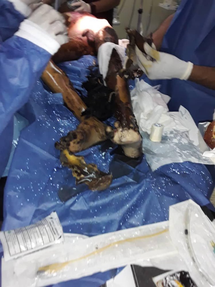 Uno de los niños heridos es atendido por personal médico.