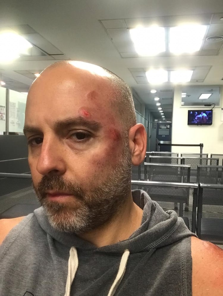 El director teatral debió suspender sus vacaciones por los golpes que sufrió