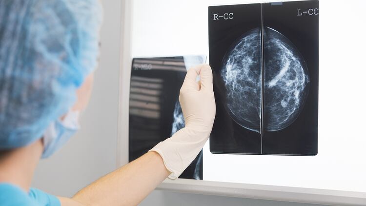 Incansablemente se estudian nuevas alternativas de tratamiento que mejoren la calidad de vida de los pacientes oncológicos (Shutterstock)