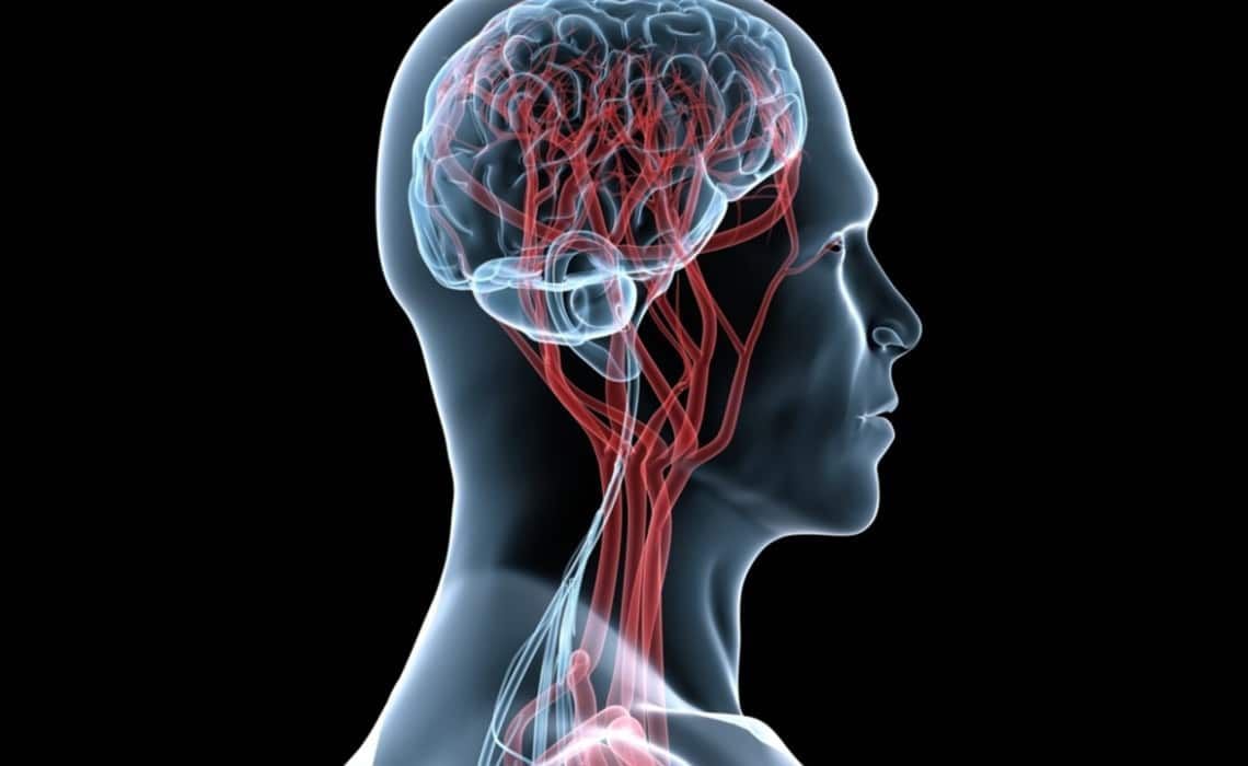 Los derrames cerebrales se pueden controlar gracias a los fármacos que se han desarrollado en los últimos años (Cortesía)