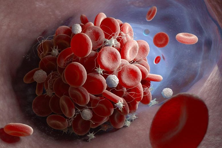 Cuál es la vitamina que ayuda a la coagulación de la sangre y previene  enfermedades cardiovasculares - Infobae