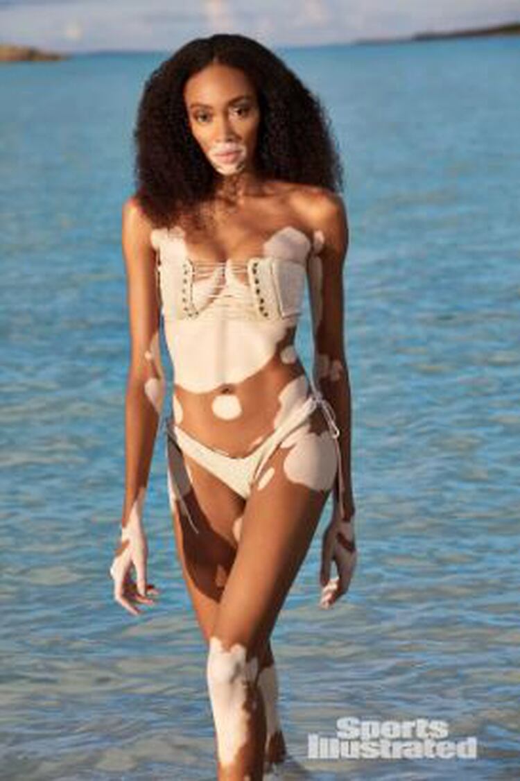 Winnie Harlow en Sports Illustrated (Foto: Sports Illustrated)