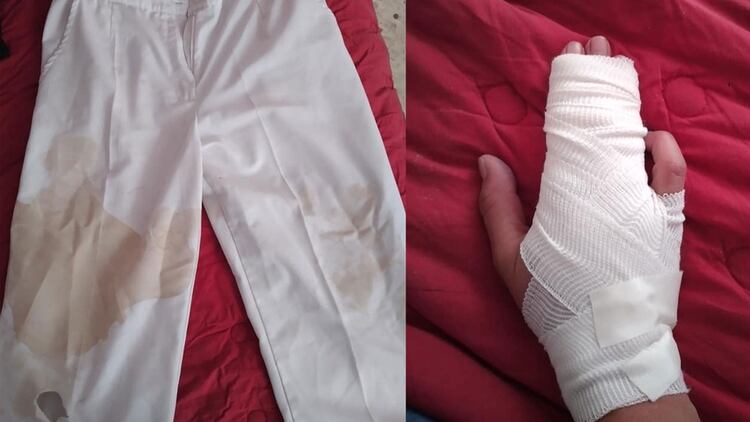 La enfermera golpeda en San Luis Potosí publicó fotografías de su uniforme y su vendaje (Foto: Facebook Sandra Alemán Arellano)