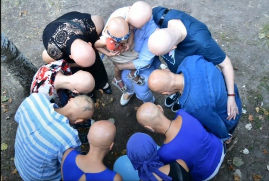 La unión de algunas de las integrantes del grupo Vivir con Alopecia Argentina en uno de los encuentros