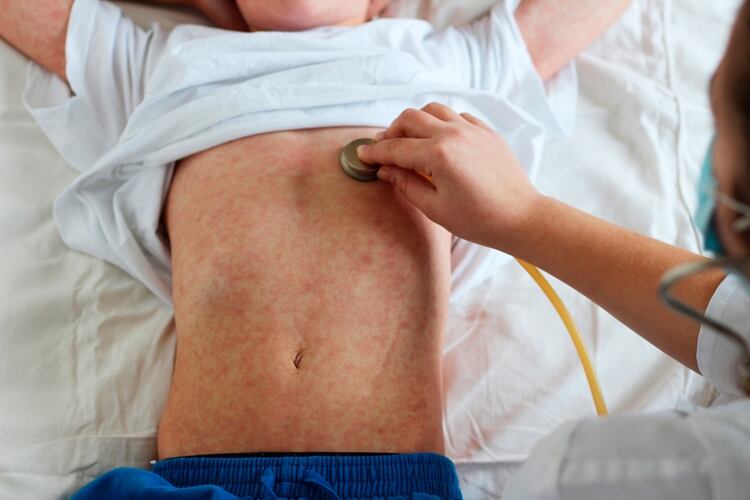 Ante la presencia de los primeros síntomas, los especialistas recomiendan consultar inmediatamente un centro de salud y evitar contacto con otras personas y lugares concurridos (Shutterstock)