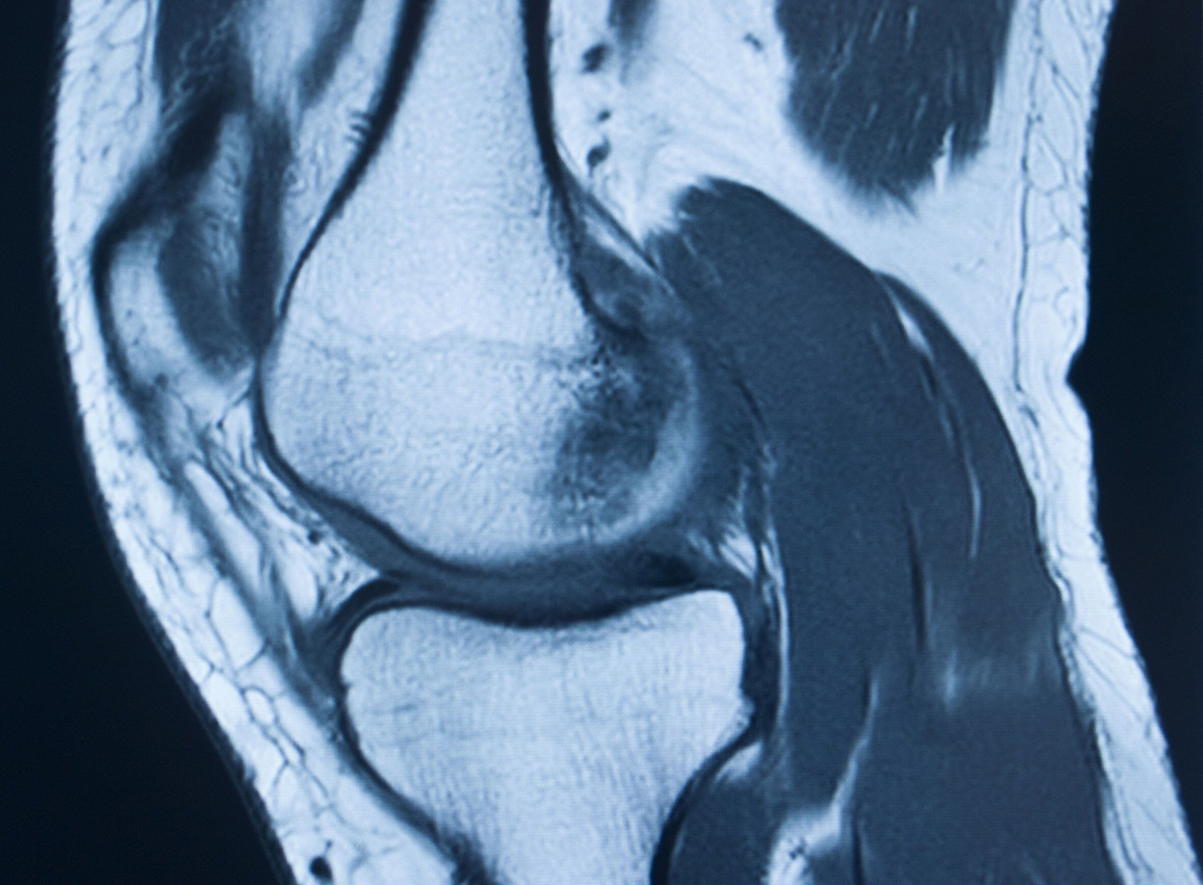 Las inflamaciones y el dolor intenso son las principales consecuencias de este problema. (Europa Press/EDWARD OLIVE)