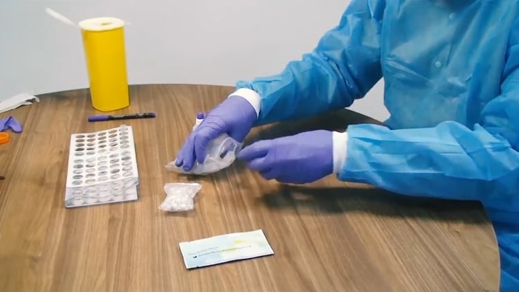 El Ministerio de Sanidad ya aplica un test rápido para confirmar en menos tiempo a los infectados (Foto: Ministerio de sanidad España)