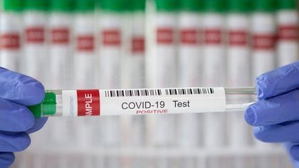 El test de detección más común es con PCR, pero requiere equipamiento más complejo que otras pruebas / REUTERS/Dado Ruvic/Illustration