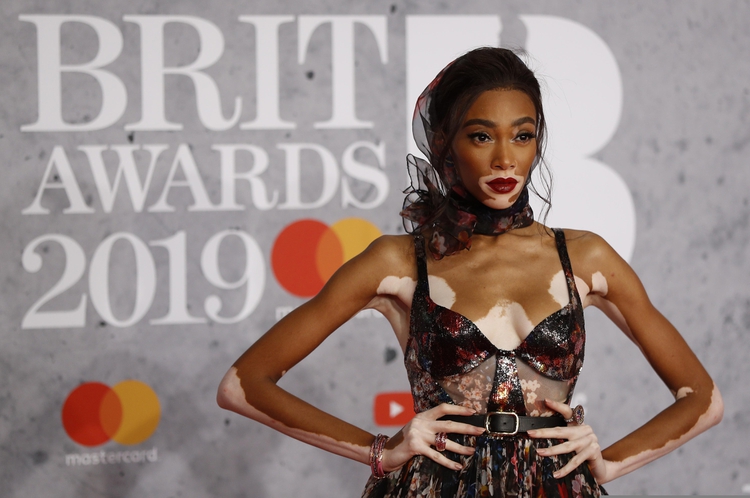 Winnie Harlow arrives for the Brit Awards at the O2 Arena in London, Britain, February 20, 2019. REUTERS/Peter Nicholls