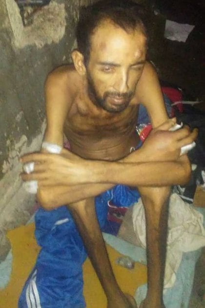 La desnutrición por falta de alimentos es una de las principales causas de muerte en las cárceles venezolanas.