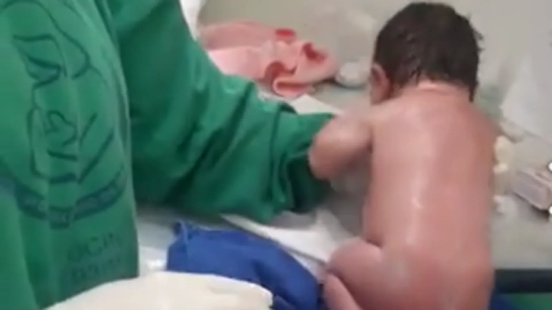 A los 20 minutos de nacer, un recién nacido en Brasil dio sus primeros pasos (Facebook)