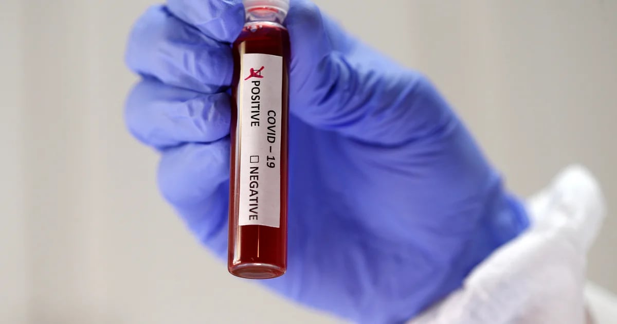 “Tests, tests y más tests”: la receta que recomiendan los especialistas para ganarle al coronavirus