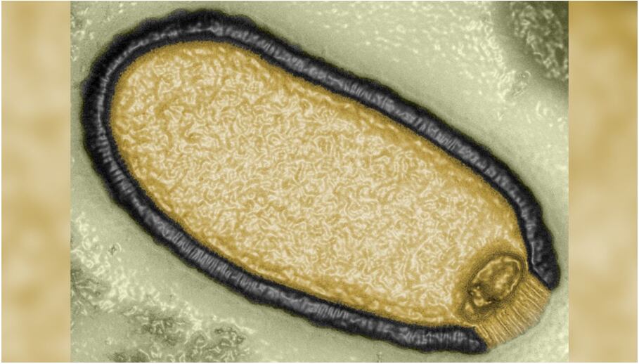 microfotografía mejorada de Pithovirus sibericum de permafrost de 30,000 años de antigüedad en 2014. credito Jean-Michel Claverie, profesor emérito de medicina y genómica en la Facultad de Medicina de la Universidad de Aix-Marseille en Marsella, Francia,