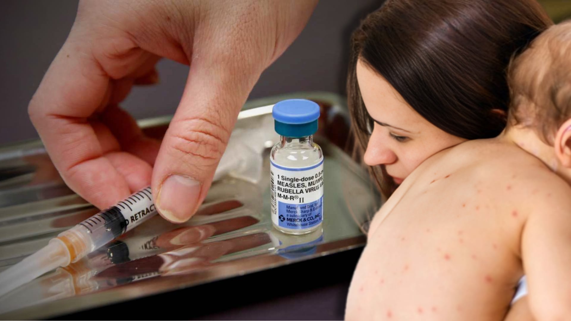 Las consecuencias de no vacunar a menores de edad contra el sarampión pueden llevar a los niños a sufrir graves consecuencias en su salud. (Foto: Composición - Infobae/Renato SIlva)