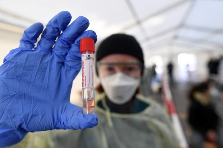 El Ministerio de Salud comenzó con la distribución de 35 mil reactivos en todo el país para detectar el coronavirus