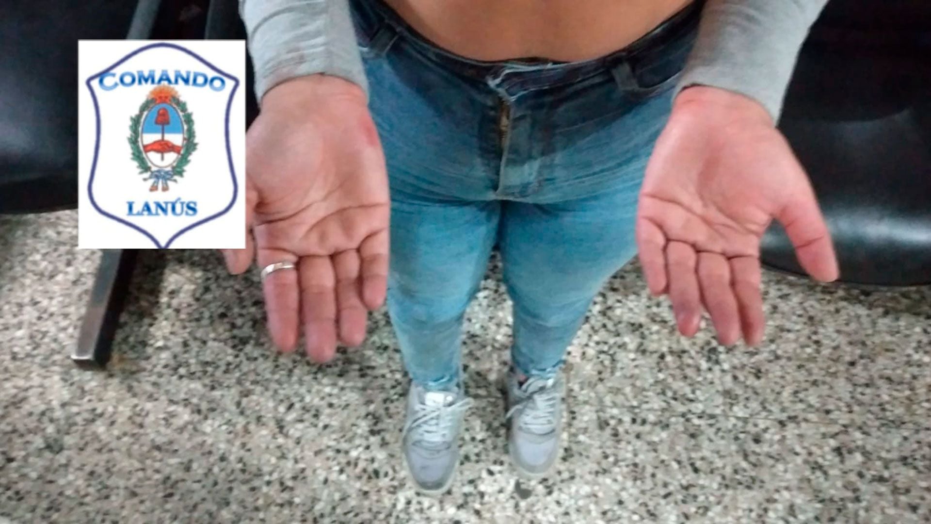 Algunas de las lesiones que sufrió la víctima de violencia de género en Lanús Oeste. 