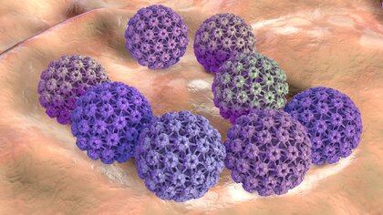 Se sabe que el factor causal más importante es la exposición al virus del papilloma humano (HPV) (Shutterstock.com)