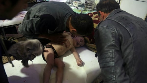 Un niÃ±o es atendido en un hospital sirio luego del ataque con armas quÃ­micas del rÃ©gimen de Assad sobre Duma. (Reuters)