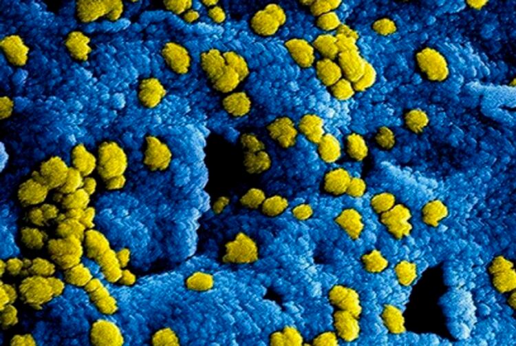 Imagen de un coronavirus en el microscopio (Foto: Cortesía UNAM)