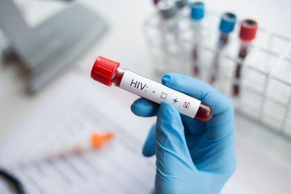 Las personas que tienen entre 18 y 59 años y viven con VIH independientemente del recuento de los niveles de células CD4 y los niveles de carga viral están ahora dentro de los grupos priorizados para la vacunación contra el COVID (Foto: Shutterstock)