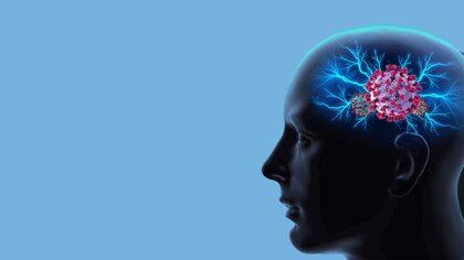 En tiempos de pandemia, es necesario mantener un cerebro activo y lejos de algunos trastornos como el de ansiedad (Shutterstock)
