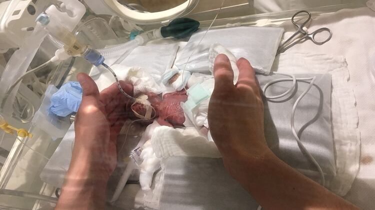 El bebÃ© naciÃ³n pesando apenas 268 gramos (Keio University School of Medicine, Department of Pediatrics/Reuters)