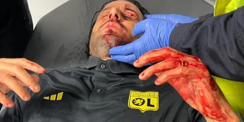 Las imágenes de la brutal agresión al micro del Lyon que derivó en la suspensión del clásico ante el Marsella: las heridas que sufrió el DT Fabio Grosso 